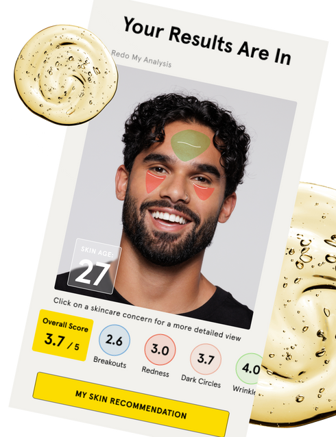 Image with the results of the test