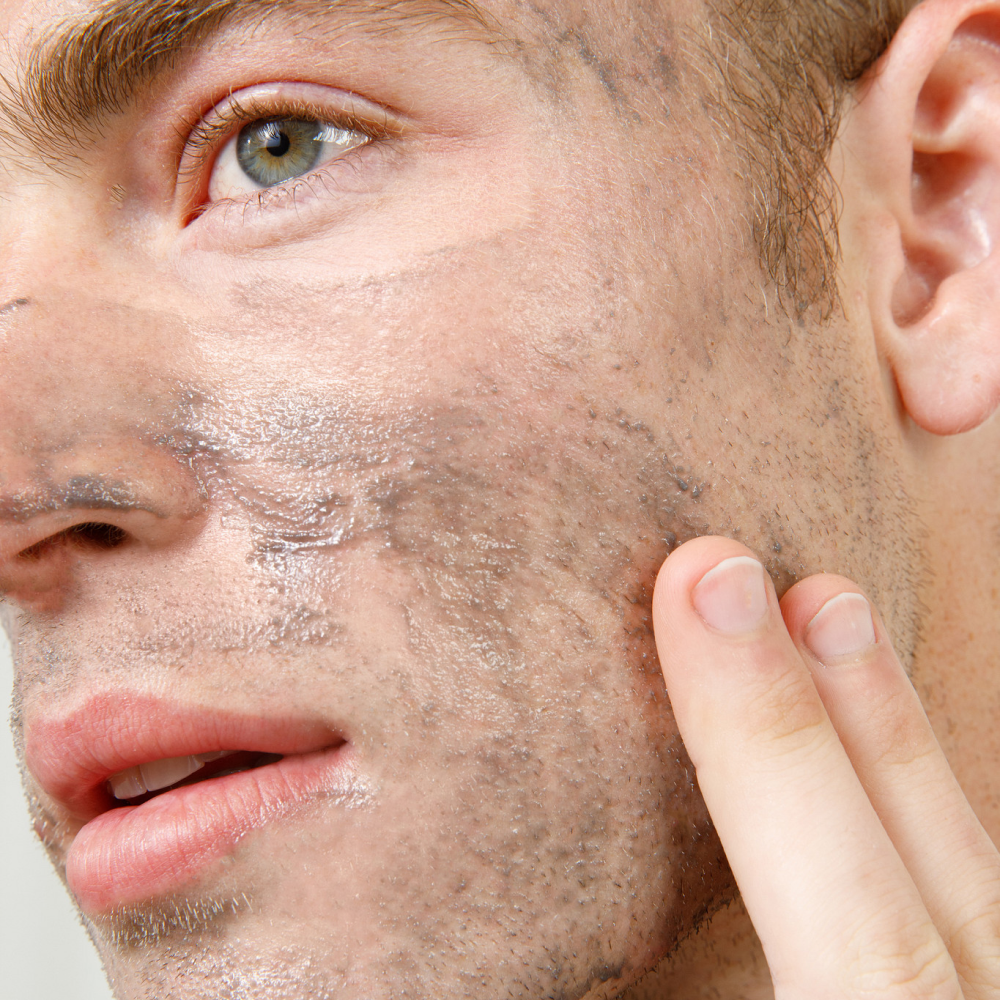 Close-up of man applying transparent facial gel on stubbled skin, skincare routine for men, moisturizing and hydrating face care.