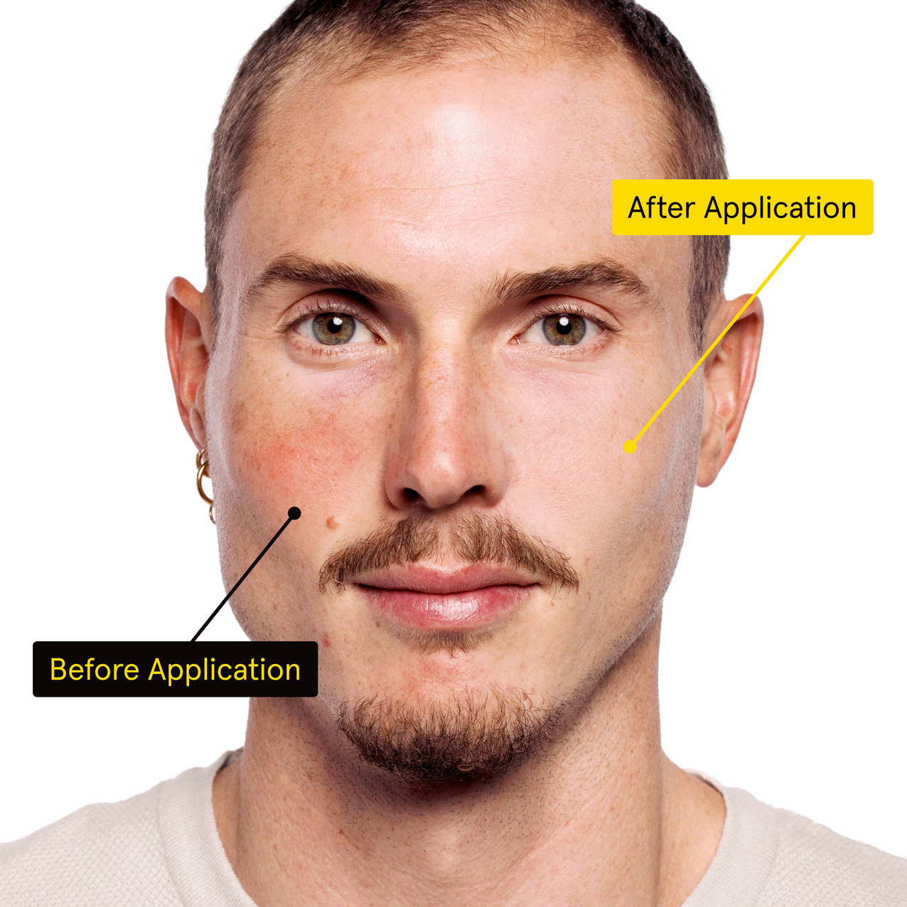 lumin pdp irc before after