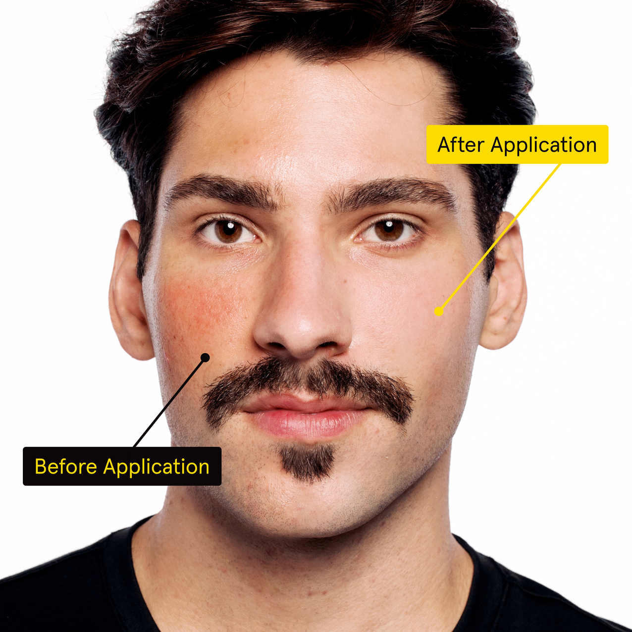 lumin pdp irc before after